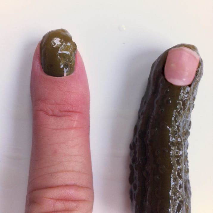 Dijamin nggak tenang melihat 10 foto ini, bikin ngilu banget