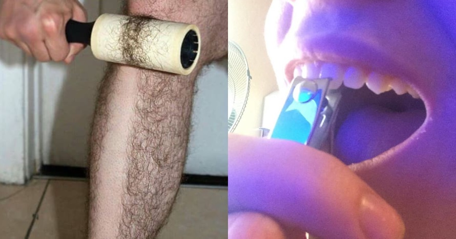 Dijamin nggak tenang melihat 10 foto ini, bikin ngilu banget