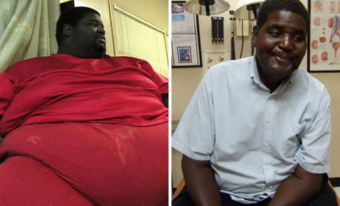 Transformasi 15 orang obesitas turunkan berat badan ini bikin melongo