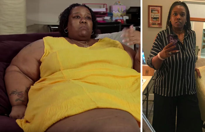 Transformasi 15 orang obesitas turunkan berat badan ini bikin melongo