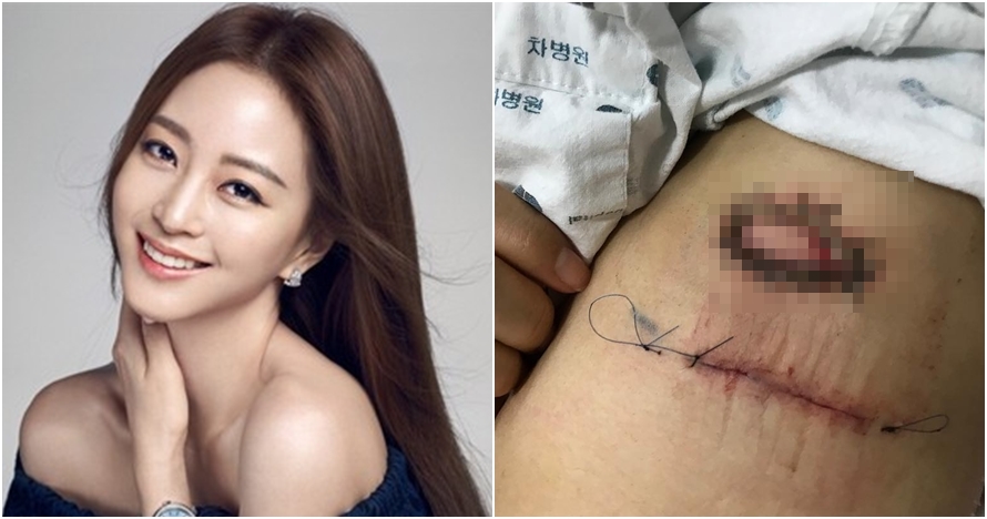 10 Gaya Han Ye-seul, aktris Korea yang sempat jadi korban malapraktik
