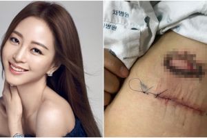 10 Gaya Han Ye-seul, aktris Korea yang sempat jadi korban malapraktik