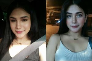 Cewek ini terlihat cantik, lihat penampilannya yang dulu bikin syok