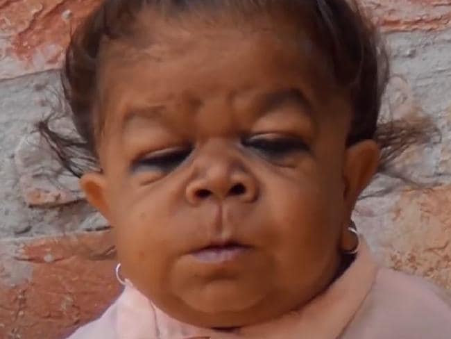 Terlihat seperti anak balita, ternyata usia laki-laki ini bikin syok