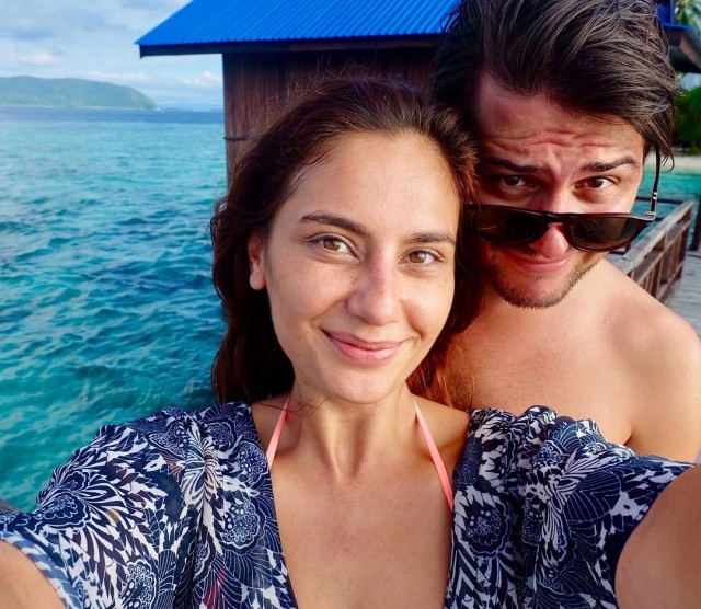 Tak biasa, 5 seleb cantik ini justru berani pamer flek hitam di wajah