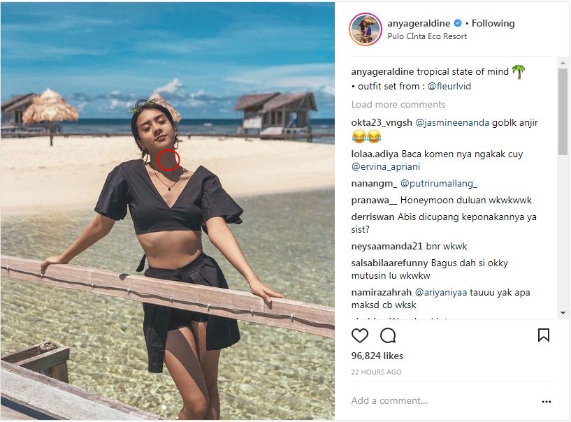 Liburan bareng Bio One, tanda merah di leher Anya Geraldine disorot
