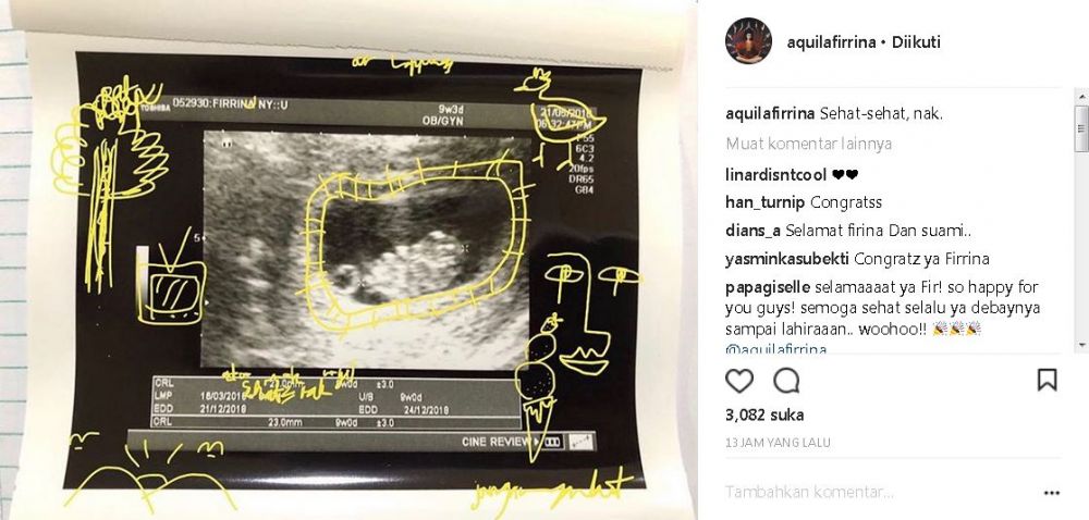 Dua bulan menikah, istri Petra Sihombing umumkan kabar kehamilan