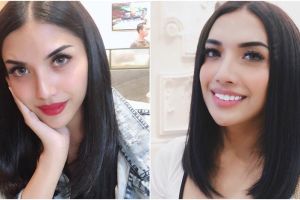 Unggah foto tanpa makeup, Millen malah tuai cibiran pedas karena ini