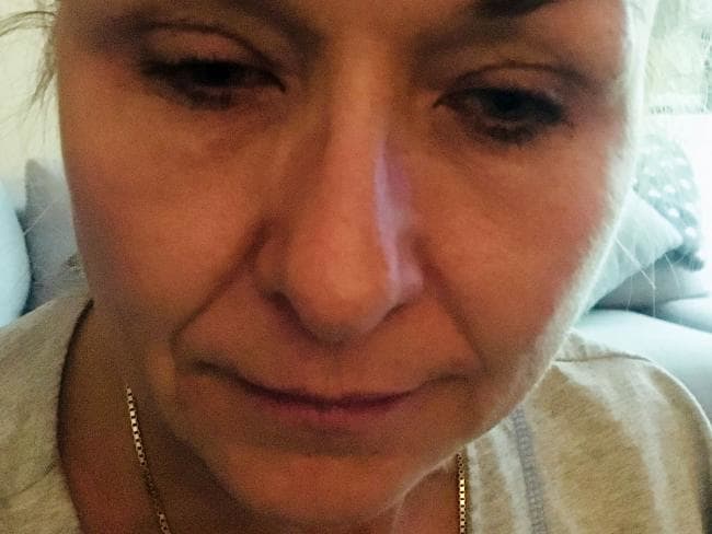 Tak pernah hapus maskara selama 25 tahun, wanita ini nyaris buta