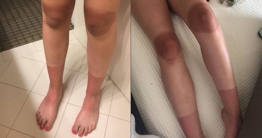 Pakai jeans kekinian, ini 7 potret kondisi kulit setelah memakainya