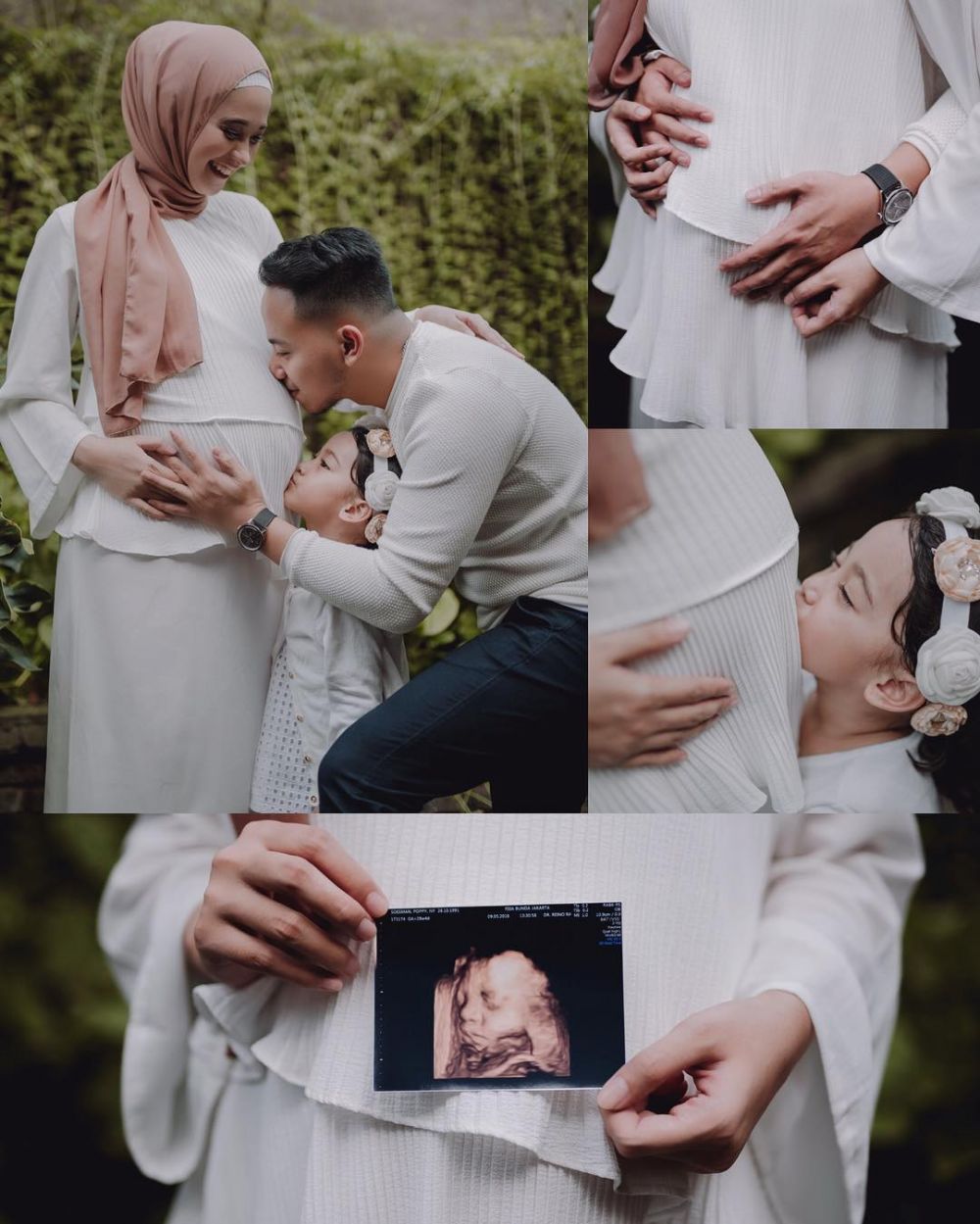11 Potret maternity Poppy Bunga hamil anak kedua, hangat & penuh makna