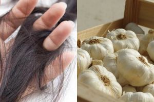 Penemuan menakjubkan! Bawang putih ternyata ampuh atasi rambut rontok