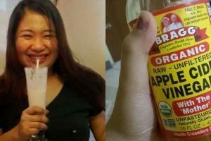 10 Pesona Donie Lin, cewek yang hits setelah sukses diet dengan cuka