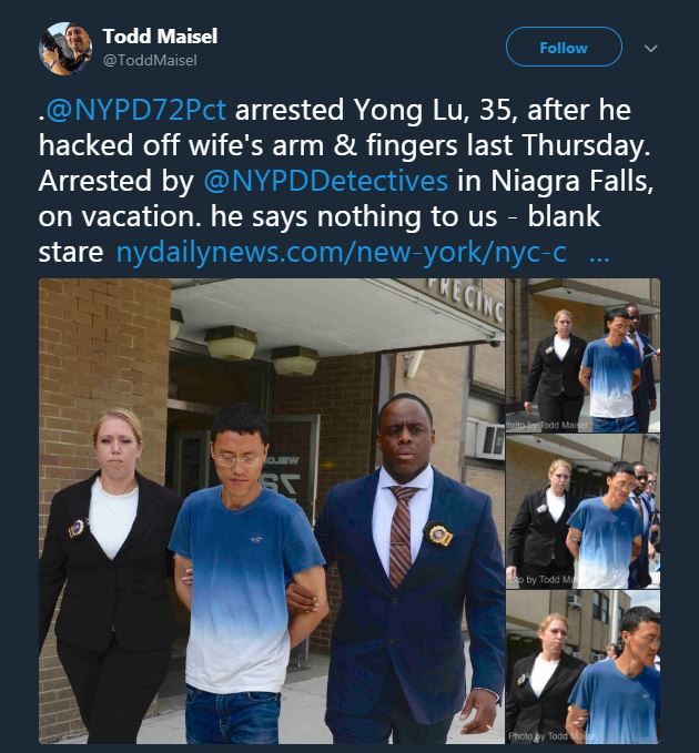 Berantem hebat, cowok ini potong lengan pasangannya yang sedang hamil