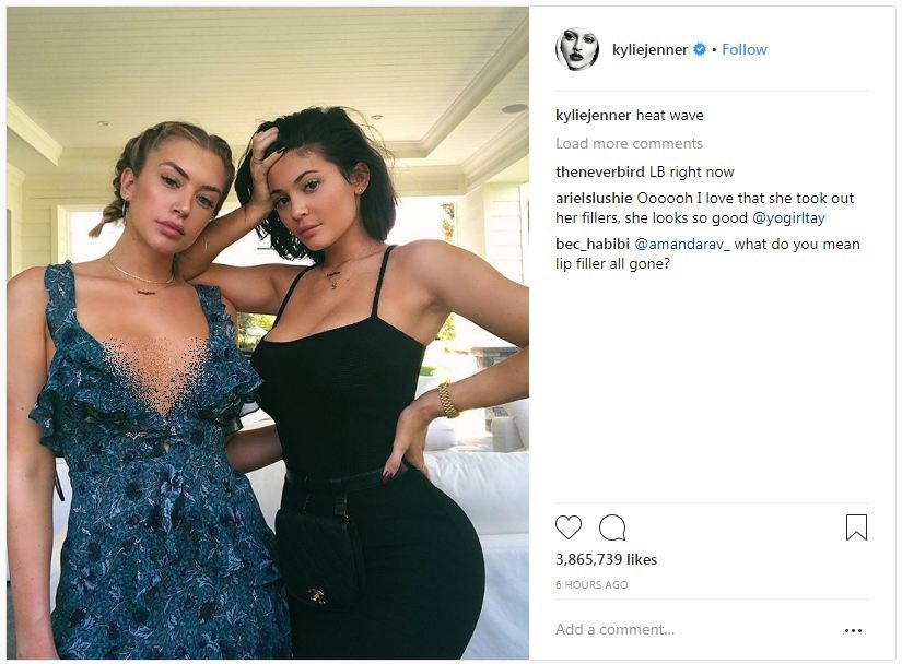 Lepas suntik filler di bibir, Kylie Jenner dipuji habis-habisan