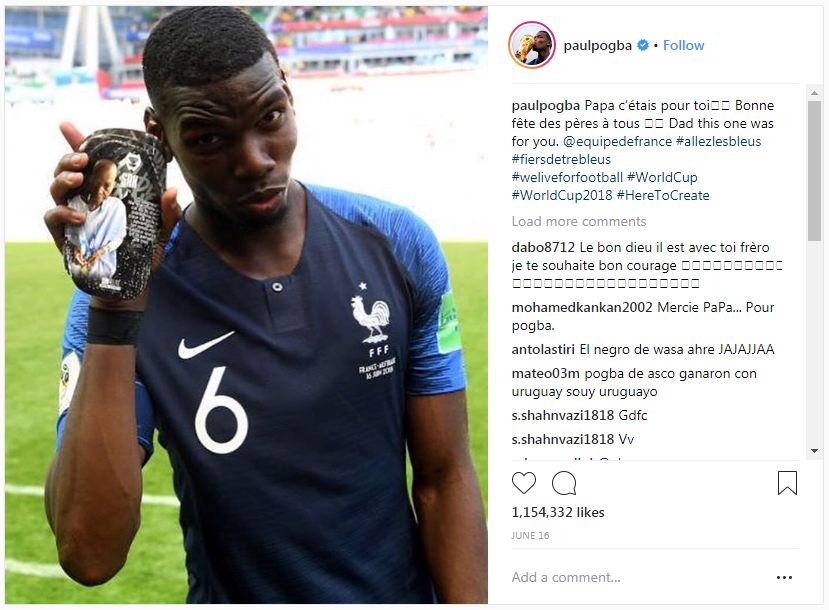 Juara Piala Dunia 2018, pelindung tulang kering Pogba jadi sorotan 