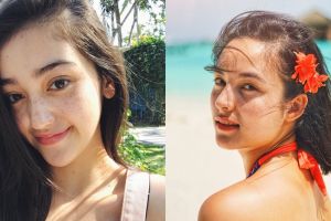 Tanpa makeup, 8 seleb ini makin memesona dengan freckles alami