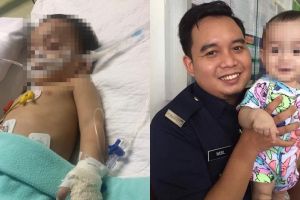 Jatuh dari ayunan, kondisi bayi 10 bulan ini berakhir memilukan