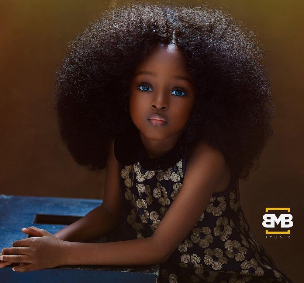 5 Potret Jare, bocah kulit hitam yang dijuluki gadis tercantik sedunia