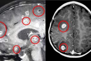 6 Bulan alami pusing, yang ditemukan di kepala bocah ini bikin kaget