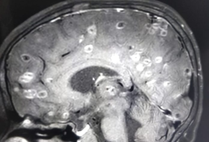 6 Bulan alami pusing, yang ditemukan di kepala bocah ini bikin kaget