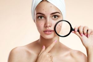 7 Jenis makanan yang tak kamu duga ini ampuh hilangkan jerawat