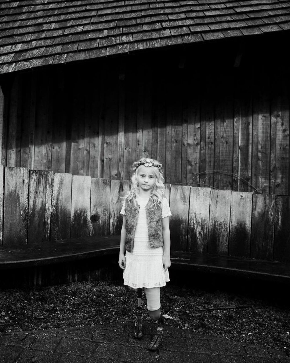 10 Potret Daisy-May Demetre, model cilik yang kedua kakinya diamputasi