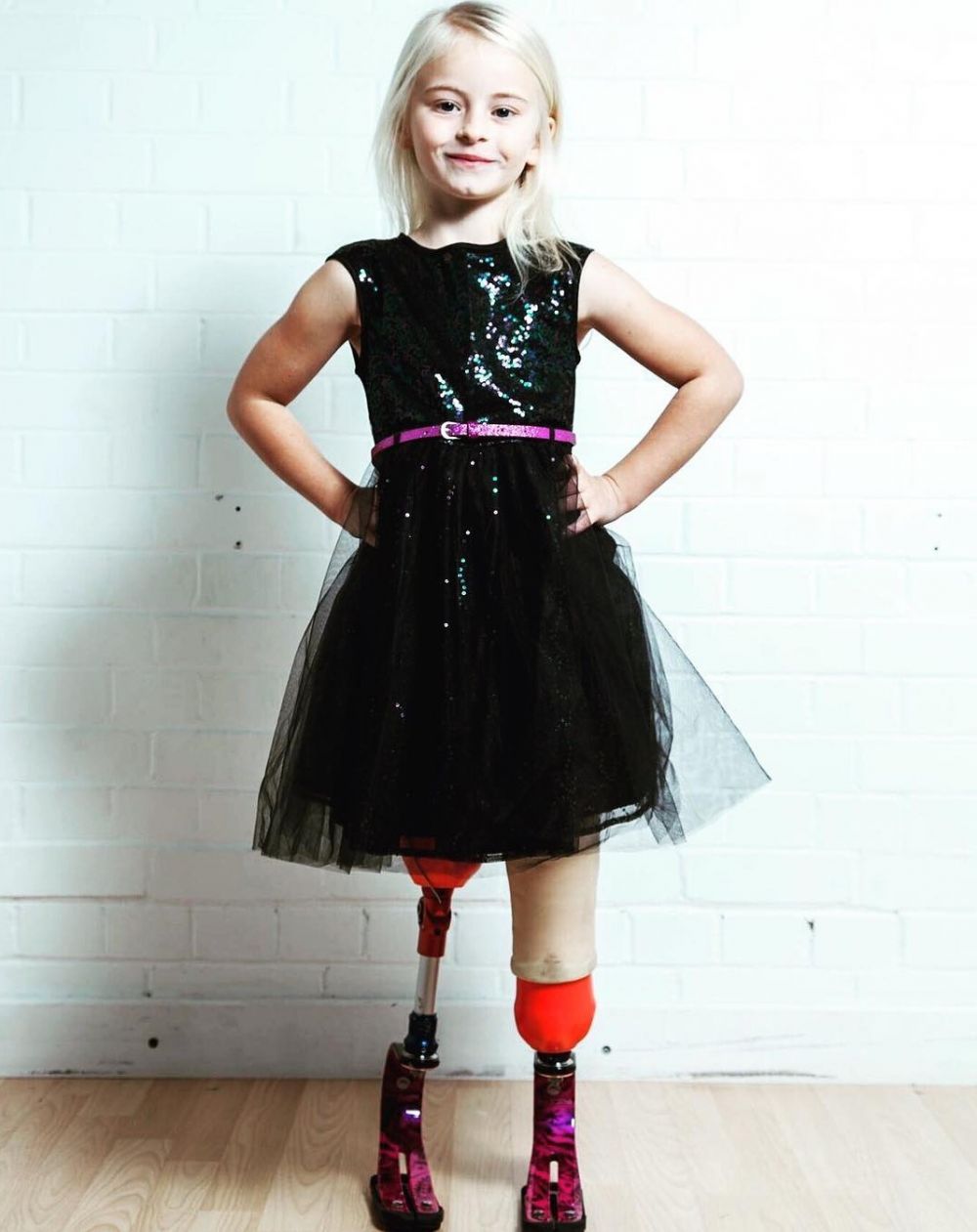 10 Potret Daisy-May Demetre, model cilik yang kedua kakinya diamputasi