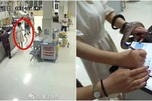 Digigit ular di semak-semak, reaksi wanita ini malah tak terduga
