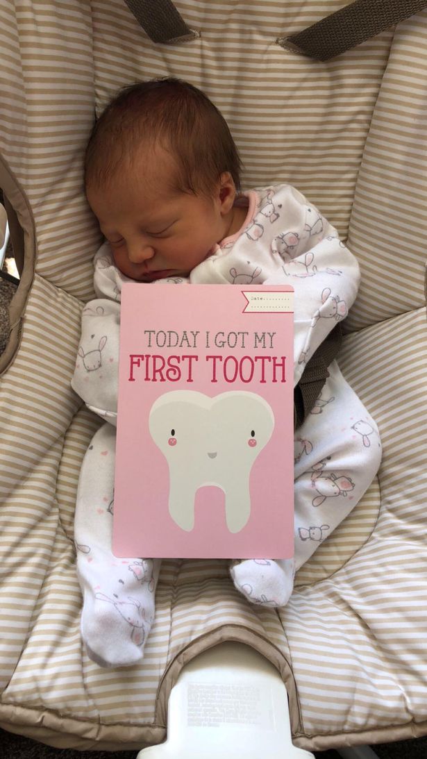 Jadi pasien termuda, bayi usia 12 hari ini dicabut giginya