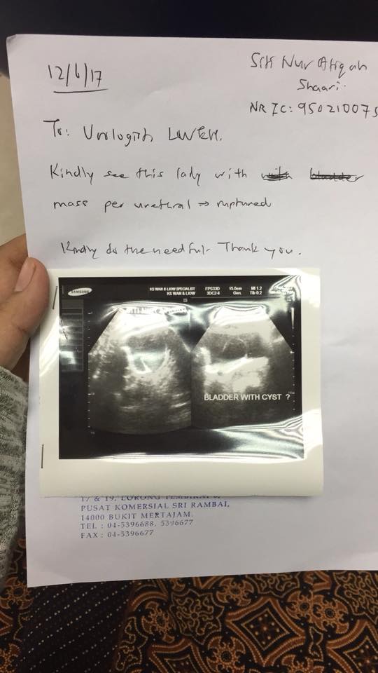 Pengen kulit putih dan cantik, kondisi wanita ini endingnya miris