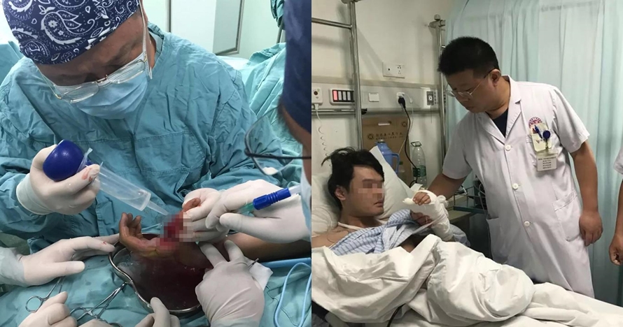 Gara-gara botol minuman soda meledak, jempol siswa ini nyaris putus