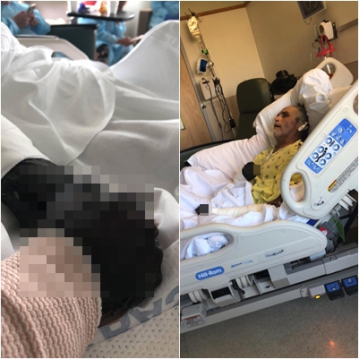 Gara-gara tergores cangkang kepiting, nasib lelaki ini di ujung tanduk