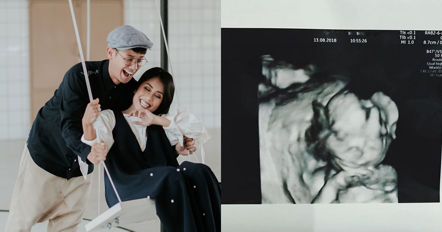 Posting foto USG, istri Tarra Budiman umumkan kehamilan anak pertama