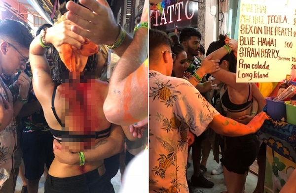Gara-gara hal sepele, wanita ini diserang pakai botol secara brutal