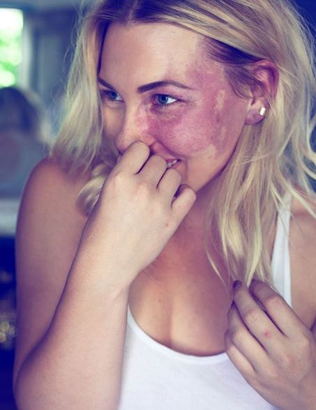 10 Kreasi makeup untuk tutupi tanda lahir ini menakjubkan banget