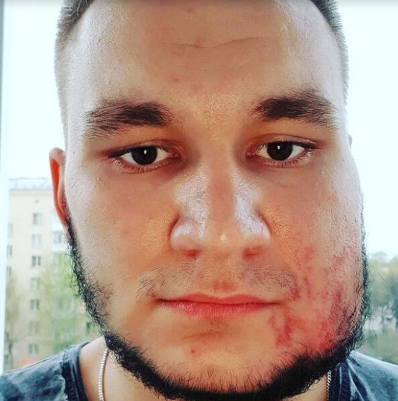 Aneh tapi nyata, kontes saling tampar ini benar-benar ada 