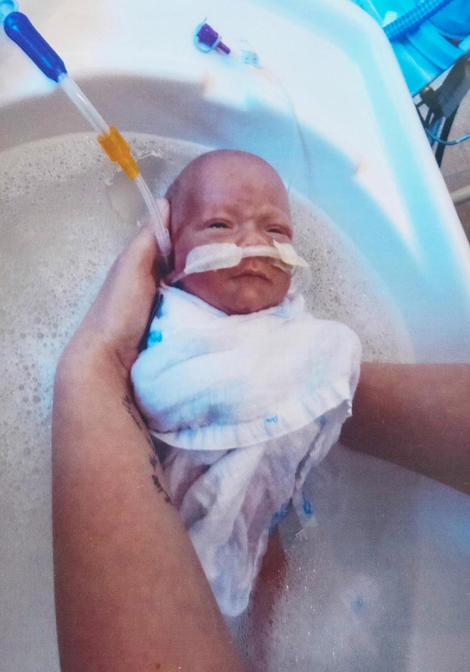 Kisah Theo Taylor, bayi seukuran kaleng soda yang bertahan hidup