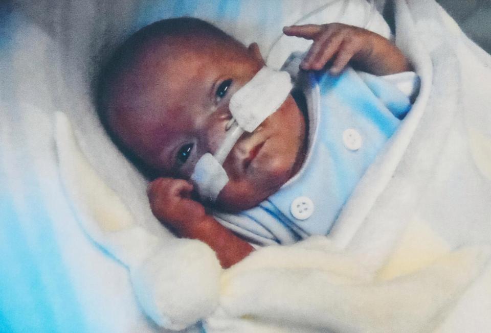 Kisah Theo Taylor, bayi seukuran kaleng soda yang bertahan hidup