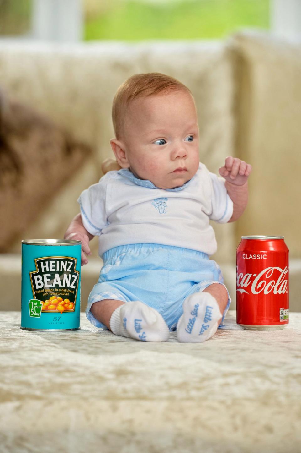 Kisah Theo Taylor, bayi seukuran kaleng soda yang bertahan hidup