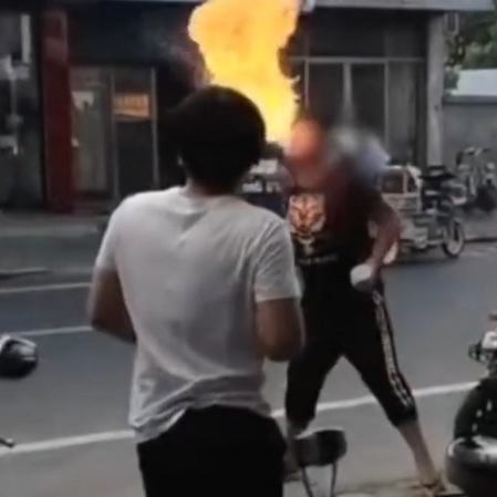 Niat bikin kagum teman, remaja ini malah berujung bakar wajah sendiri