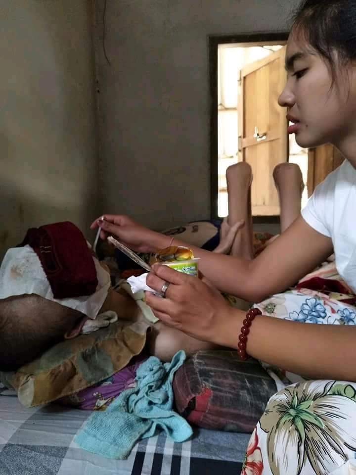 Kekasih derita kanker ganas, 10 momen kesetiaan cewek ini bikin haru