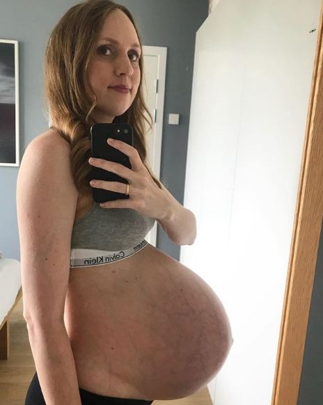 Wanita ini mengandung 3 bayi kembar, 10 potretnya bikin melongo
