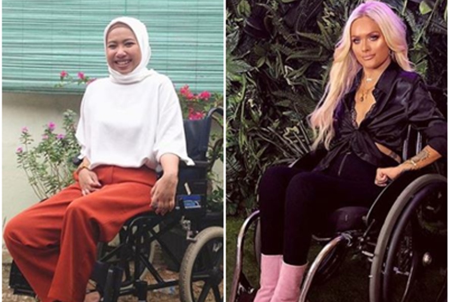 Fisiknya tak sempurna, 7 cewek ini sukses jadi beauty vlogger