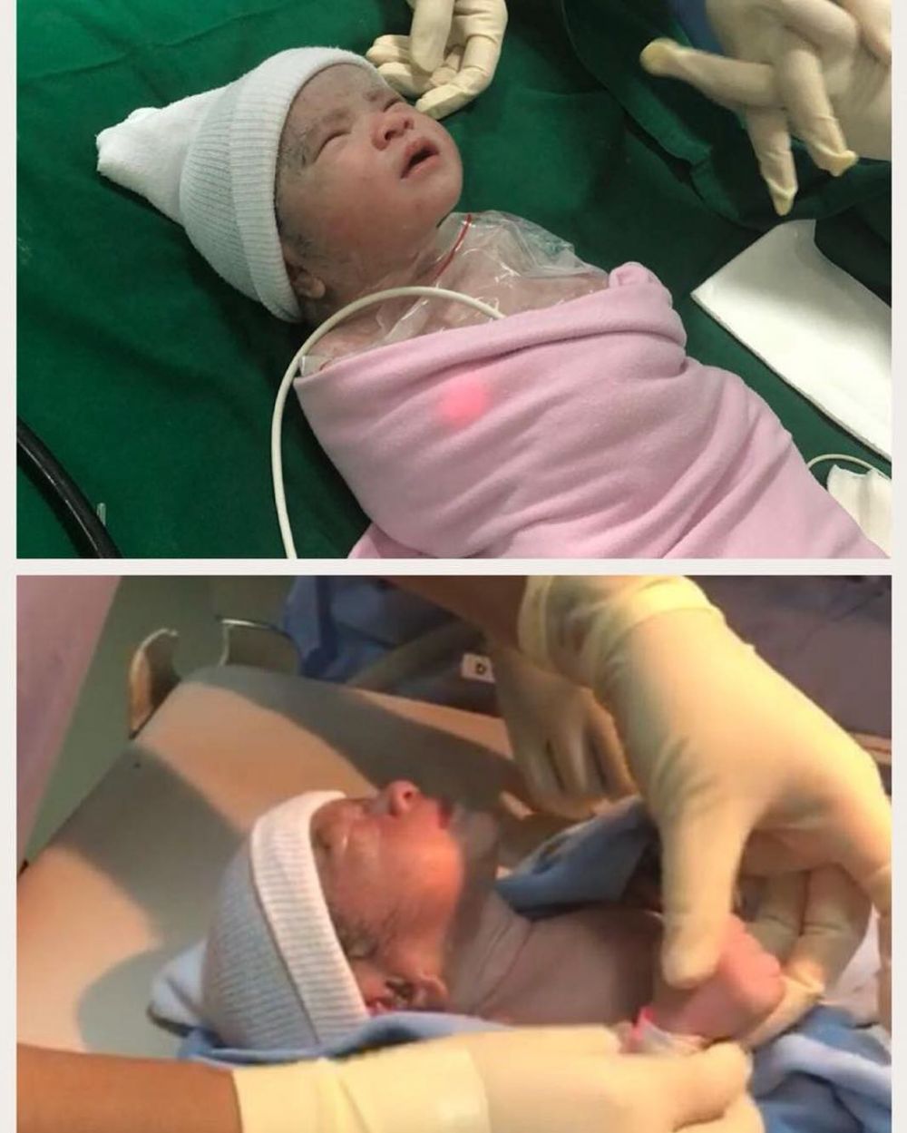 Presenter Eat Bulaga, Fiona Fachru lahirkan bayi kembar pengantin 