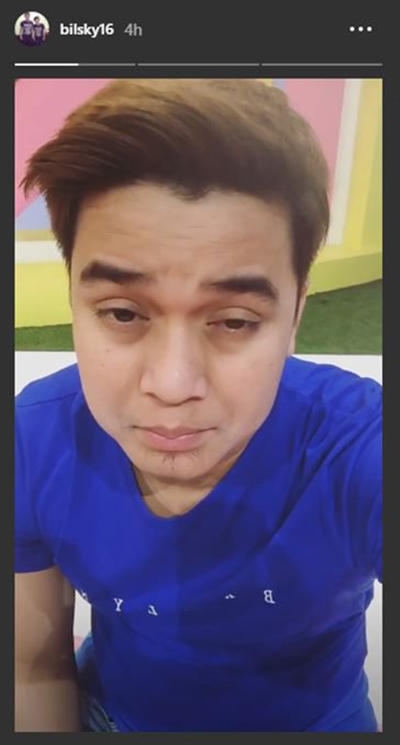 4 Seleb ini unggah foto mata sembab habis putus cinta, sedih berat?