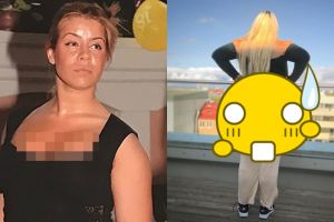 Cewek ini ketagihan operasi pembesaran pantat, 10 fotonya bikin kaget