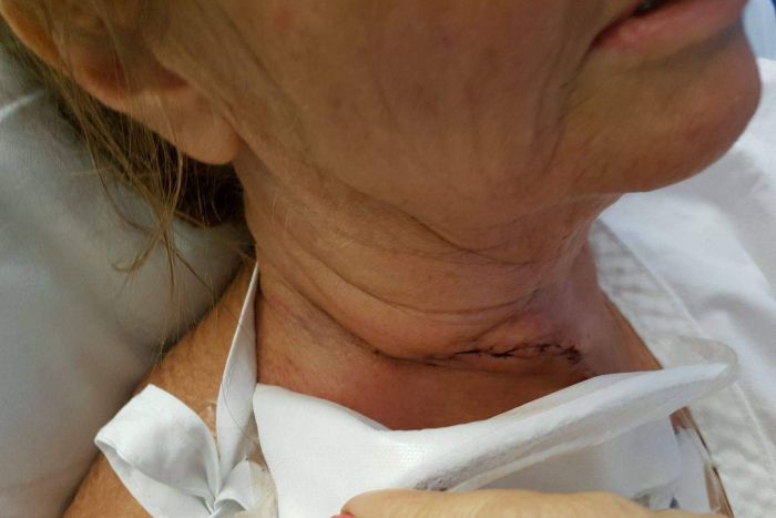 Disambar ikan 'terbang' saat mancing, nenek ini nyaris meregang nyawa