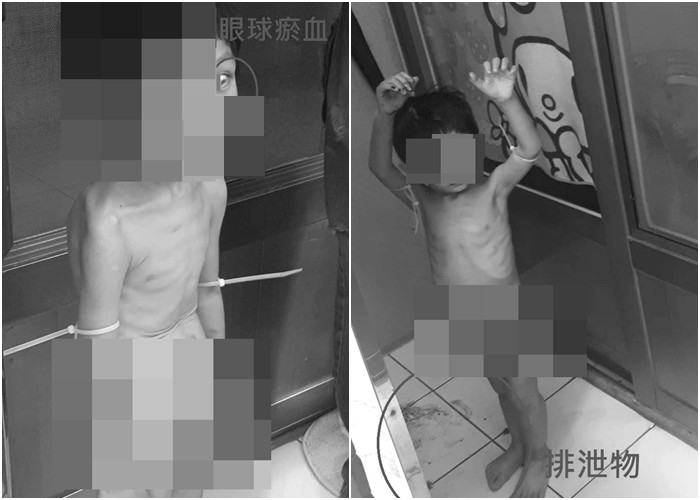 Kisah pilu bocah 3 tahun disiksa ayahnya, sampai makan kotoran sendiri