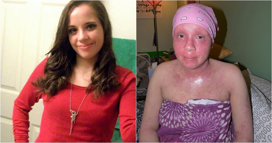 Gara-gara salah pakai krim kulit, nasib wanita ini berakhir tragis